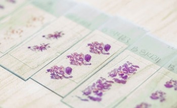 AI-Powered Tumor Analysis Could Revolutionize Cancer Treatment