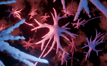 AI Unlocks New Secrets to Alzheimer's Disease