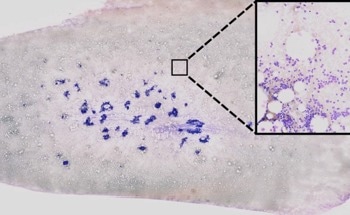 New Method for Recognizing Genetic Aberrations