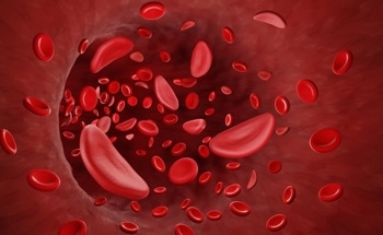 Anemia Treatment with PHD Inhibitor