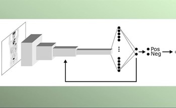 AI System Effectively Identifies Signs of Lymphoma in Scans