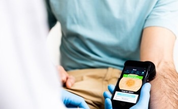 AI-Based Clinical Decision Support Tool for Cutaneous Melanoma Detection