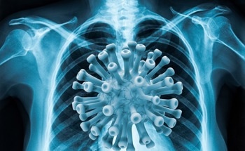 Deep Learning Detects COVID-19 Signatures in Lung Ultrasound Images