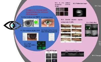 AI-Powered Solutions for Personalized Therapeutic Interventions in Dry Eye Disease