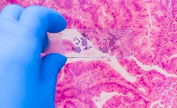 AI-Powered Model Identifies Most Potent Cancer-Killing Immune Cells