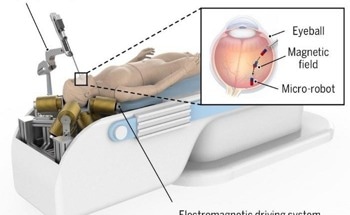 Novel Design Optimizes Electromagnetic System for Safer Eye Surgery