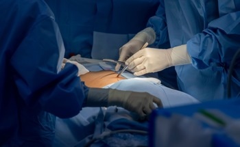 Robotic vs. Conventional Laparoscopy for Treating Deep Endometriosis