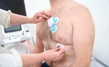SmartSleeve: A Soft Robotic Device for Epicardial Drug Delivery