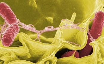 Machine Learning Reads Microscopy Images for Antibiotic Resistance