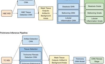 AI Enhances Liver Disease Diagnostics