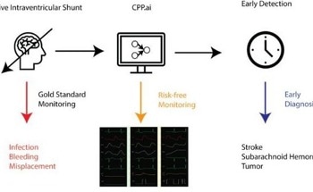 AI Detects Intracranial Hypertension Without Invasive Procedures