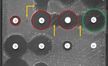 AI-Powered System Identifies Antibiotic-Resistant Bacteria