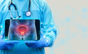 New AI Model Predicts Prostate Cancer Aggressiveness and Risk