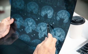 Deep Learning Elevates the Precision of Brain Surgery