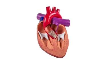 Predicting Cardiovascular Mortality with Deep Learning