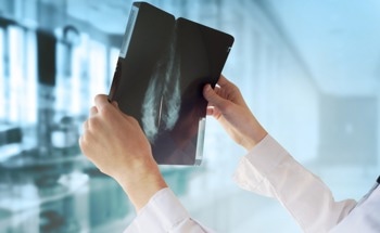 AI-Driven Analysis of Immune Cells Predicts Triple-Negative Breast Cancer Prognosis