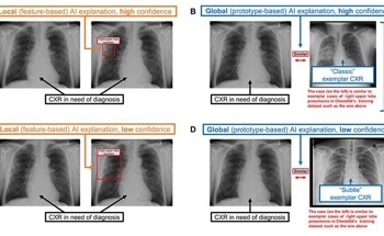 The Role of Human Judgment in AI-Assisted Diagnosis
