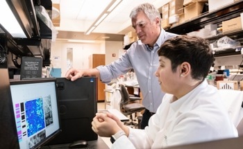 AI as a Game-Changer in Alzheimer’s Disease Detection