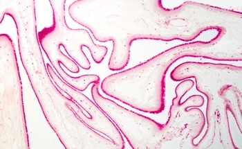 New AI Tool Could Revolutionize Placental Examination