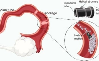 Microrobots Revolutionize Fallopian Tube Treatment