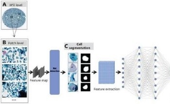 Improving Cervical Cancer Screening with AI