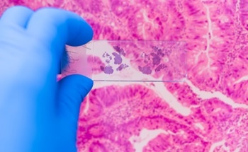 Uncovering Key Cancer Driver Genes Through Graph Machine Learning