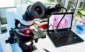 AI Improves Accuracy of Fetal Heart Defect Diagnosis