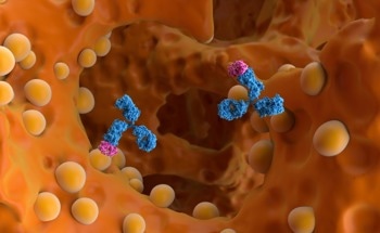 AI Prediction System for Idiopathic Multicentric Castleman's Disease
