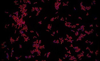 New AI Platform Revolutionizes TB Drug Discovery by Analyzing Cell Images