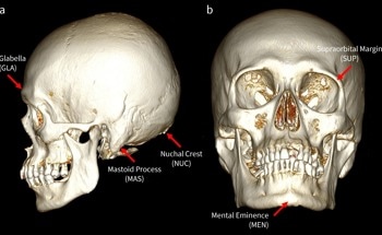 New AI Tool Dramatically Improves Forensic Skull Identification