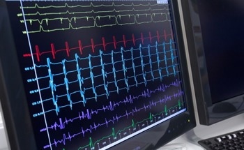 AI Predicts Cardiovascular Risk in Women