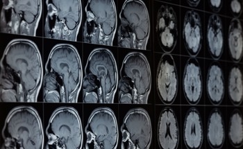 AI Tool for Forensic TBI Investigations