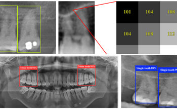 Deep Learning Model for Accurate Detection of Tooth and Sinus Structures in Dental X-rays