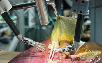 Next-Gen Surgical Robots with Enhanced Flexibility