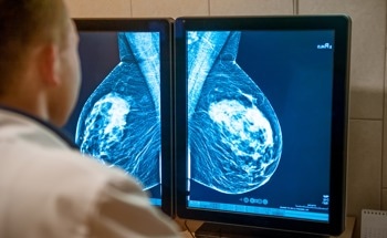 AI Boosts Radiologists’ Accuracy in Breast Cancer Detection
