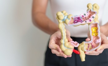 AI-Powered Tool to Revolutionize Dietary Management of IBD