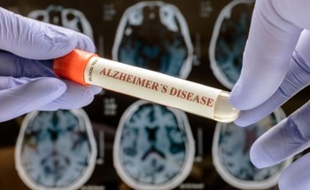 AI Tool Offers Early Warning System for Dementia—Years Before Symptoms Begin