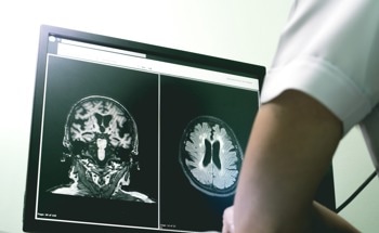 AI Tool Uses EEG Signals to Support Early Dementia Diagnosis