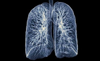 NHS Launches AI and Robotic Pilot to Speed Up Lung Cancer Diagnosis