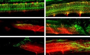 Microrobots Repair Spinal Cord